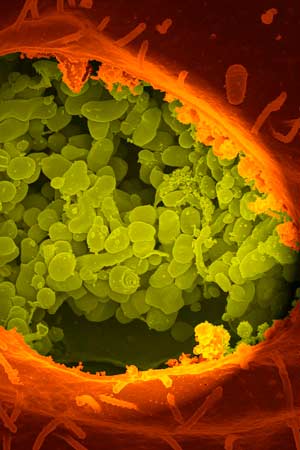 An electron scanning microscope image of a Vero cell exposing the contents of a vacuole where Coxiella burnetii are busy growing.