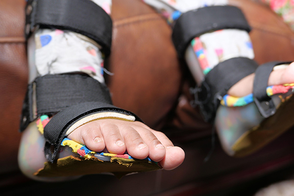 a child wearing orthotics