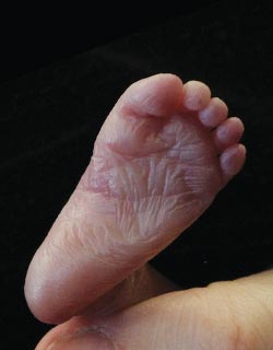 a babys foot